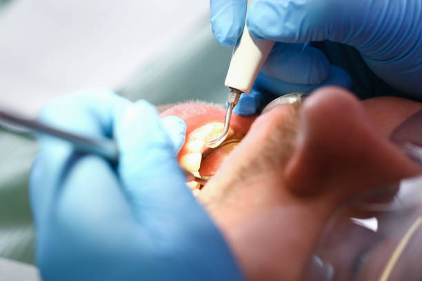 Best Teeth Whitening  in Forestville, OH