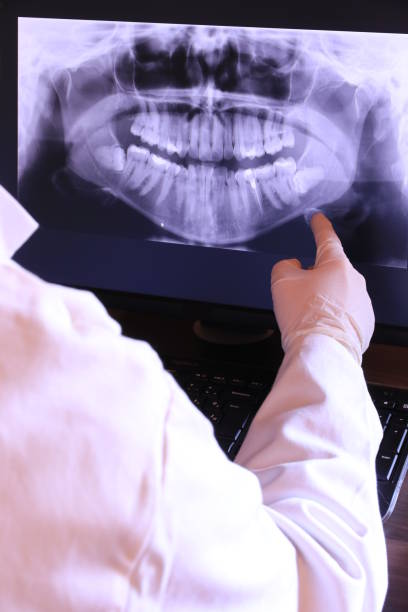Best Tooth Infection Emergency Dentist  in Forestville, OH