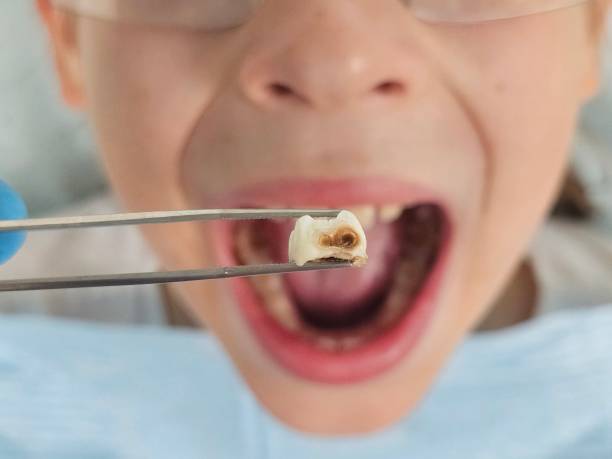 Best Emergency Gum Pain Relief  in Forestville, OH